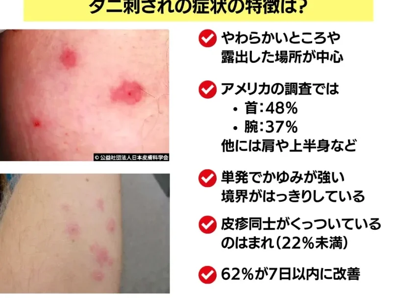 ダニに刺されてから痒くなるまでの時間について