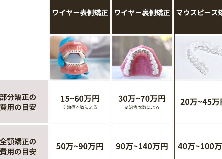 マウスピースの費用と種類について詳しく解説