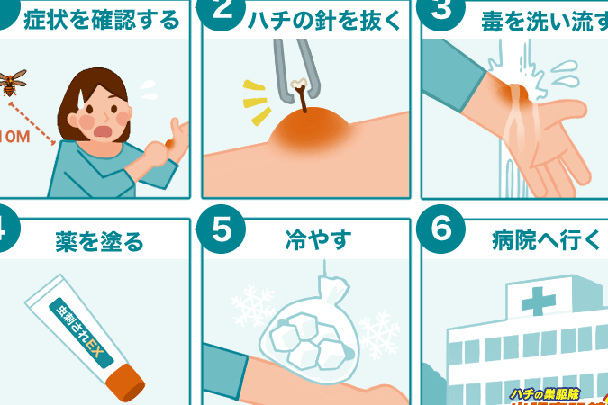 蜂に刺された後、症状が出るまでの時間は？